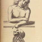 1682 SURGERY 1st ed Observations of Janszoon Meekeren | Dutch Medicine Plates