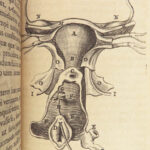 1682 SURGERY 1st ed Observations of Janszoon Meekeren | Dutch Medicine Plates