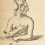 1682 SURGERY 1st ed Observations of Janszoon Meekeren | Dutch Medicine Plates