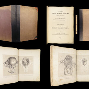 1851 Anatomy of Gravid Obstetrics OBGYN Medicine Atlas ENORMOUS FOLIO Hunter