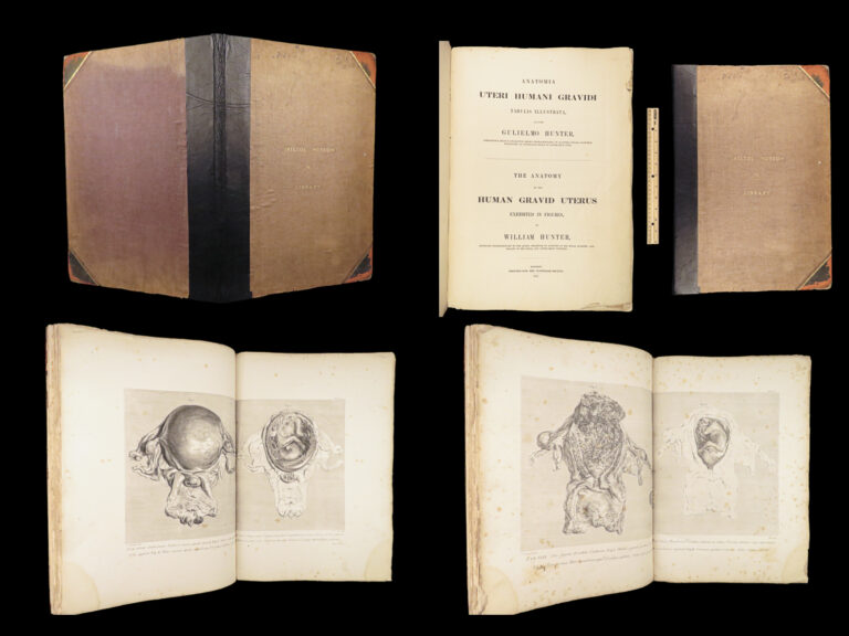 Image of 1851 Anatomy of Gravid Obstetrics OBGYN Medicine Atlas ENORMOUS FOLIO Hunter