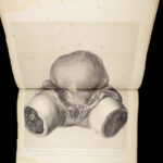 1851 Anatomy of Gravid Obstetrics OBGYN Medicine Atlas ENORMOUS FOLIO Hunter