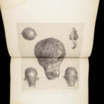 1851 Anatomy of Gravid Obstetrics OBGYN Medicine Atlas ENORMOUS FOLIO Hunter