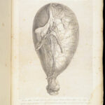 1851 Anatomy of Gravid Obstetrics OBGYN Medicine Atlas ENORMOUS FOLIO Hunter