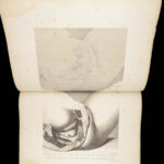 1851 Anatomy of Gravid Obstetrics OBGYN Medicine Atlas ENORMOUS FOLIO Hunter