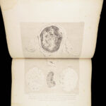 1851 Anatomy of Gravid Obstetrics OBGYN Medicine Atlas ENORMOUS FOLIO Hunter