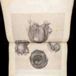 1851 Anatomy of Gravid Obstetrics OBGYN Medicine Atlas ENORMOUS FOLIO Hunter