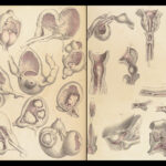 1851 Surgical ANATOMY 1st US ed by Maclise | Illustrated Surgery Medicine FOLIO