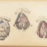 1851 Surgical ANATOMY 1st US ed by Maclise | Illustrated Surgery Medicine FOLIO