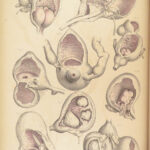 1851 Surgical ANATOMY 1st US ed by Maclise | Illustrated Surgery Medicine FOLIO
