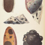 1838 Pathological Anatomy – Robert Carswell | Color Illustrated Surgery Medicine