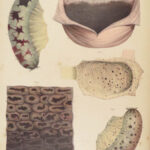 1838 Pathological Anatomy – Robert Carswell | Color Illustrated Surgery Medicine
