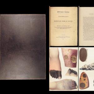 1838 Pathological Anatomy – Robert Carswell | Color Illustrated Surgery Medicine
