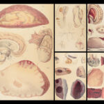 1838 Pathological Anatomy – Robert Carswell | Color Illustrated Surgery Medicine