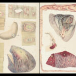 1838 Pathological Anatomy – Robert Carswell | Color Illustrated Surgery Medicine