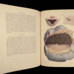 1838 Pathological Anatomy – Robert Carswell | Color Illustrated Surgery Medicine