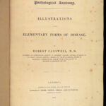 1838 Pathological Anatomy – Robert Carswell | Color Illustrated Surgery Medicine