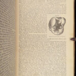 A System of Surgery – Samuel D. Gross – 1872 | 1400+ Anatomy Engravings
