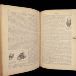 A System of Surgery – Samuel D. Gross – 1872 | 1400+ Anatomy Engravings