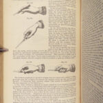 A System of Surgery – Samuel D. Gross – 1872 | 1400+ Anatomy Engravings