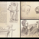 A System of Surgery – Samuel D. Gross – 1872 | 1400+ Anatomy Engravings