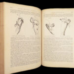 A System of Surgery – Samuel D. Gross – 1872 | 1400+ Anatomy Engravings