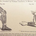A System of Surgery – Samuel D. Gross – 1872 | 1400+ Anatomy Engravings