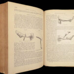 A System of Surgery – Samuel D. Gross – 1872 | 1400+ Anatomy Engravings