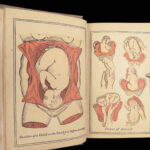 Aristotle’s Works – Anonymous – c.1855 | Color Plates, Midwifery Manual