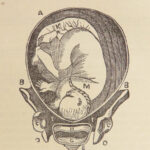 Aristotle’s Works – Anonymous – c.1855 | Color Plates, Midwifery Manual