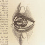 A Handy-Book of Ophthalmic Surgery – Laurence & Moon – 1866 | Eye Disease Treatment
