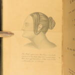 1860 – On the Loss of Teeth | Early Dentistry, Medicine & Tooth Surgery