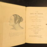 1860 – On the Loss of Teeth | Early Dentistry, Medicine & Tooth Surgery