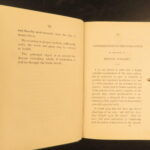 1860 – On the Loss of Teeth | Early Dentistry, Medicine & Tooth Surgery