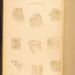 1852 Rokitansky Diseases of ARTERIES Medicine Surgery Illustrated German FOLIO