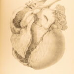 1852 Rokitansky Diseases of ARTERIES Medicine Surgery Illustrated German FOLIO