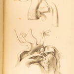 1852 Rokitansky Diseases of ARTERIES Medicine Surgery Illustrated German FOLIO