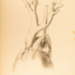 1852 Rokitansky Diseases of ARTERIES Medicine Surgery Illustrated German FOLIO