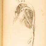 1852 Rokitansky Diseases of ARTERIES Medicine Surgery Illustrated German FOLIO