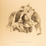 1852 Rokitansky Diseases of ARTERIES Medicine Surgery Illustrated German FOLIO