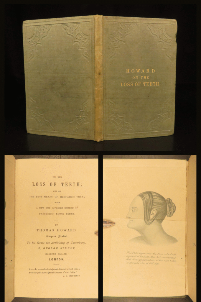 1860 – on the loss of teeth | early dentistry, medicine & tooth surgery | howard’s on the loss of teeth (ca. 1860) explores dental structure, early tooth restoration, common disorders, enamel formation, and artificial replacements in victorian england.