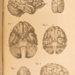 1826 – Anatomy of the Brain – Spurzheim | First English Edition – Illustrated Neurology
