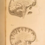 1826 – Anatomy of the Brain – Spurzheim | First English Edition – Illustrated Neurology