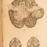 1826 – Anatomy of the Brain – Spurzheim | First English Edition – Illustrated Neurology