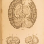 1826 – Anatomy of the Brain – Spurzheim | First English Edition – Illustrated Neurology