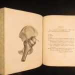 1823 Astley Cooper Medicine & Surgery Orthopedic Joint Dislocations Fractures