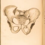1823 Astley Cooper Medicine & Surgery Orthopedic Joint Dislocations Fractures