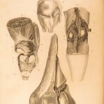 1823 Astley Cooper Medicine & Surgery Orthopedic Joint Dislocations Fractures