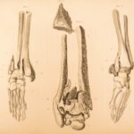 1823 Astley Cooper Medicine & Surgery Orthopedic Joint Dislocations Fractures
