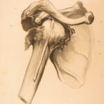 1823 Astley Cooper Medicine & Surgery Orthopedic Joint Dislocations Fractures